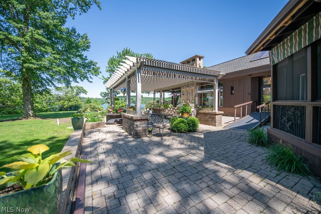 Atwood Lake - Residential